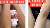 Viên uống chống nắng, trắng da: Ẩn họa sau những chiêu quảng cáo