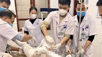 Cãi nhau với vợ, chồng đổ nửa can xăng tự thiêu