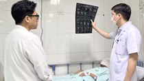 Phẫu thuật khối u xơ thần kinh "khổng lồ" che kín mặt