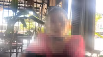 Mũi bị biến dạng sau phẫu thuật, khách hàng “tố” thẩm mỹ viện