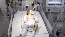 Bé gái hơn 2 tháng tuổi bị bạo hành dã man được xuất viện