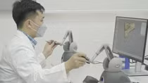 Phẫu thuật khớp gối chính xác 98% nhờ “Thước ngắm phẫu thuật” “made in Vietnam”