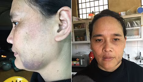 Nỗi đau tận cùng sau những cơn say