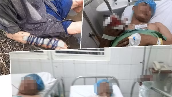 Mâu thuẫn cho thuê đất ruộng, 4 cha con bị chém trọng thương
