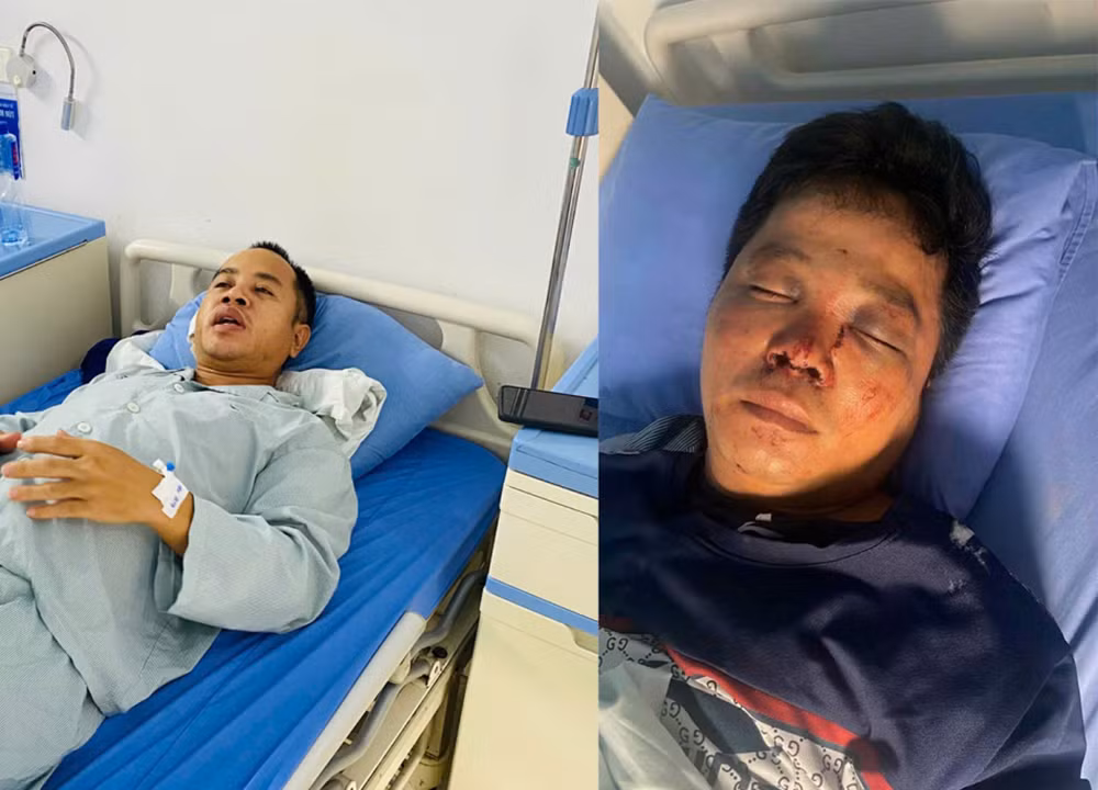 Công an đang xác minh vụ việc giúp người gặp tai nạn rồi bị hành hung -0