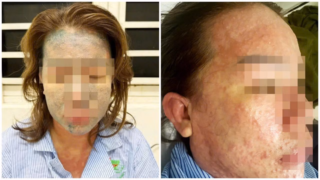 Nữ bệnh nhân nguy kịch sau khi dùng “thuốc giảm cân thải độc, collagen không rõ nguồn gốc” -0