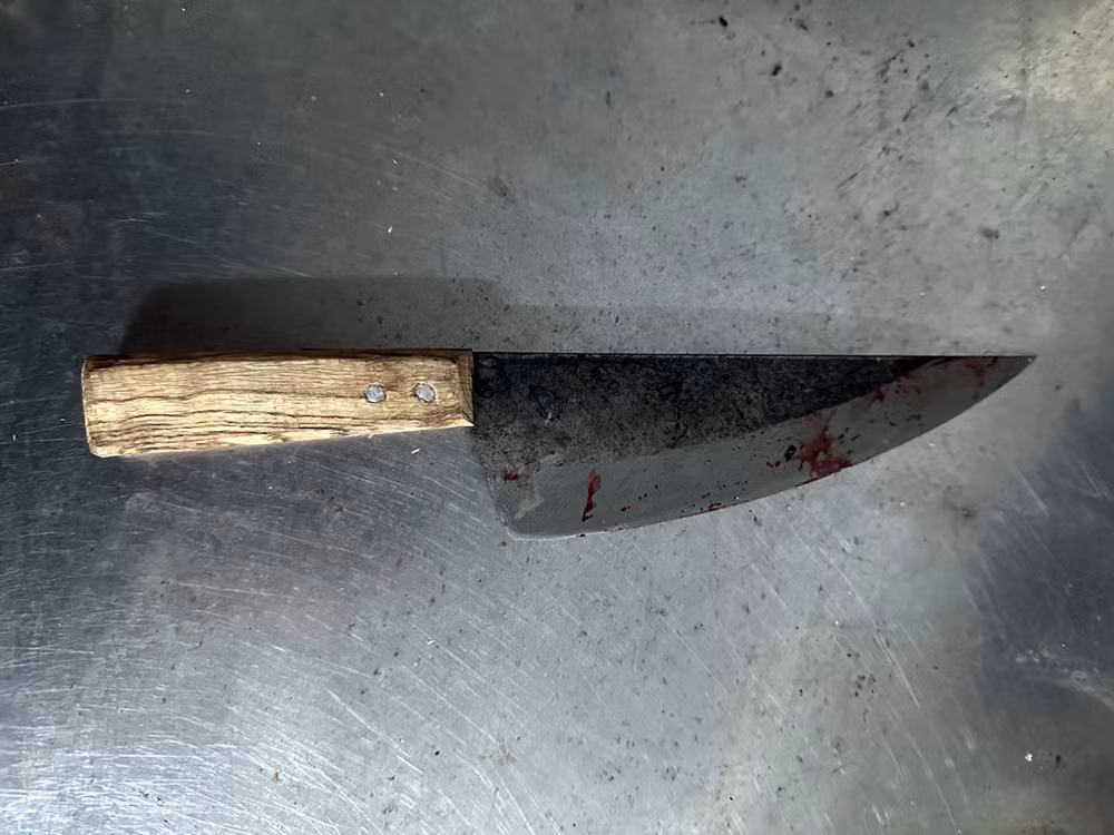 Mâu thuẫn nhỏ, hậu quả lớn -0