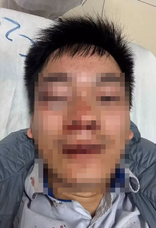 Va chạm nhẹ, người đi đường xông lên đánh lái xe buýt như phim chưởng -0