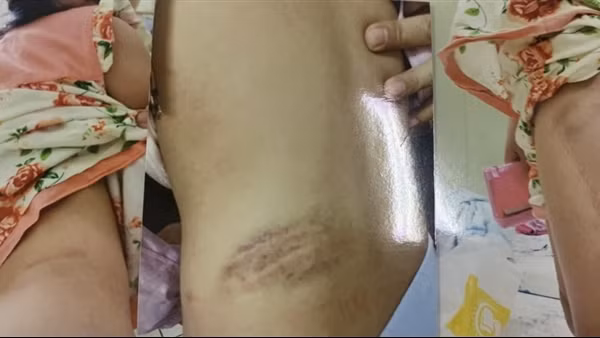 Đừng bắt những đứa trẻ phải tự chống đỡ