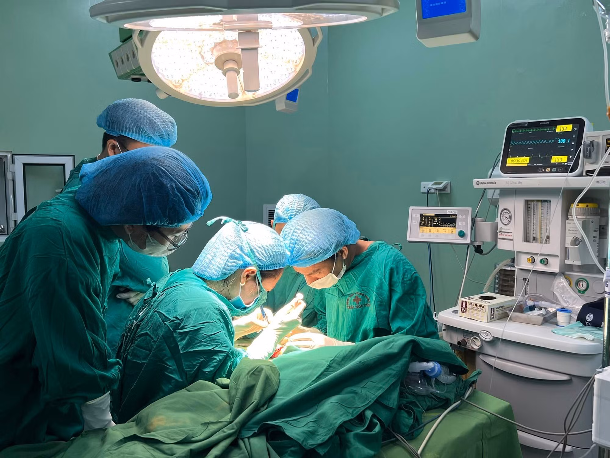 Phẫu thuật thành công cho bé 18 tháng tuổi bị máy cắt đá cán đứt lìa bàn tay -0