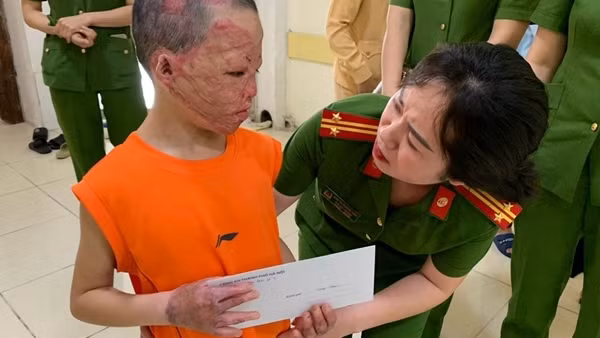Công an huyện Bảo Lâm trao 700 phần quà cho bà con nghèo ảnh 4