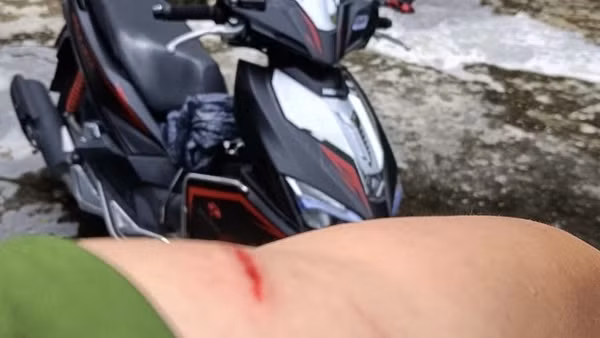 Một cán bộ Công an bị đối tượng ma túy tấn công gây thương tích