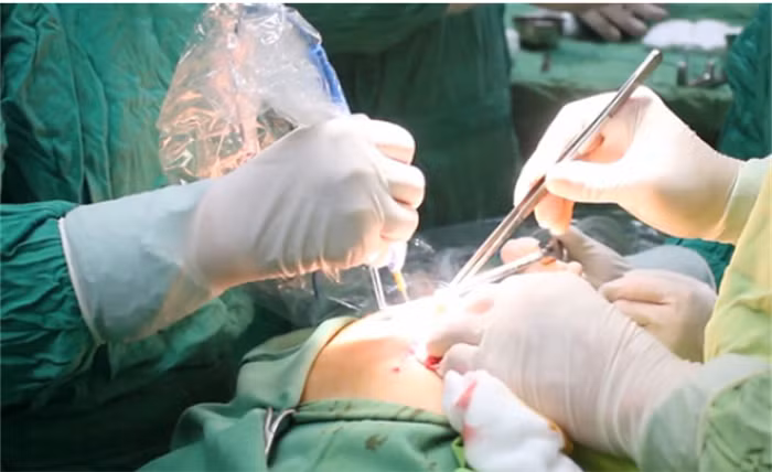 Những cái chết vì… làm đẹp -0