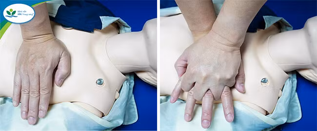 Hai bác sĩ cứu bé gái 5 tuổi đuối nước ở bể bơi tại Hạ Long -0