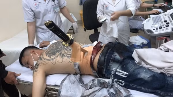 Nhờ người tình bẫy "đối thủ" đến rồi dùng kiếm Nhật đâm