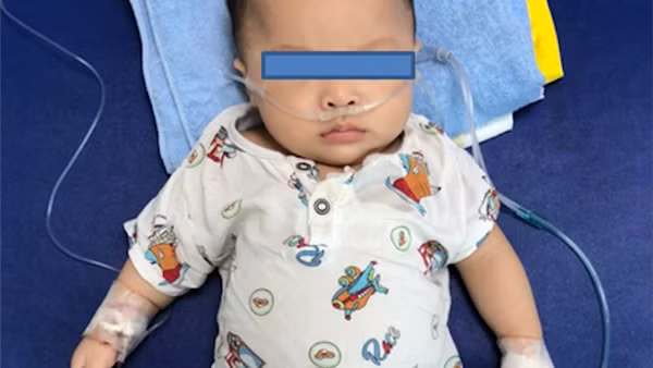 Nhiều trẻ cong vẹo cột sống nhưng đi khám muộn ảnh 2
