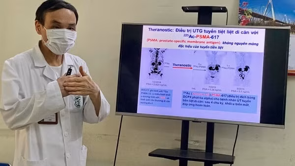 Phẫu thuật cắt thực quản, tạo hình đường tiêu hóa cho cụ ông 81 tuổi ảnh 3