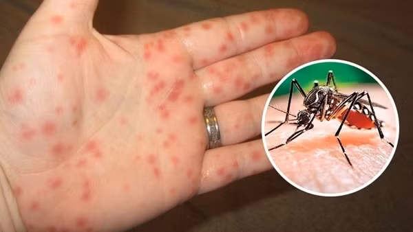 Bình Phước ghi nhận hơn 2.200 ca mắc sốt xuất huyết, có 3 ca tử vong ảnh 2