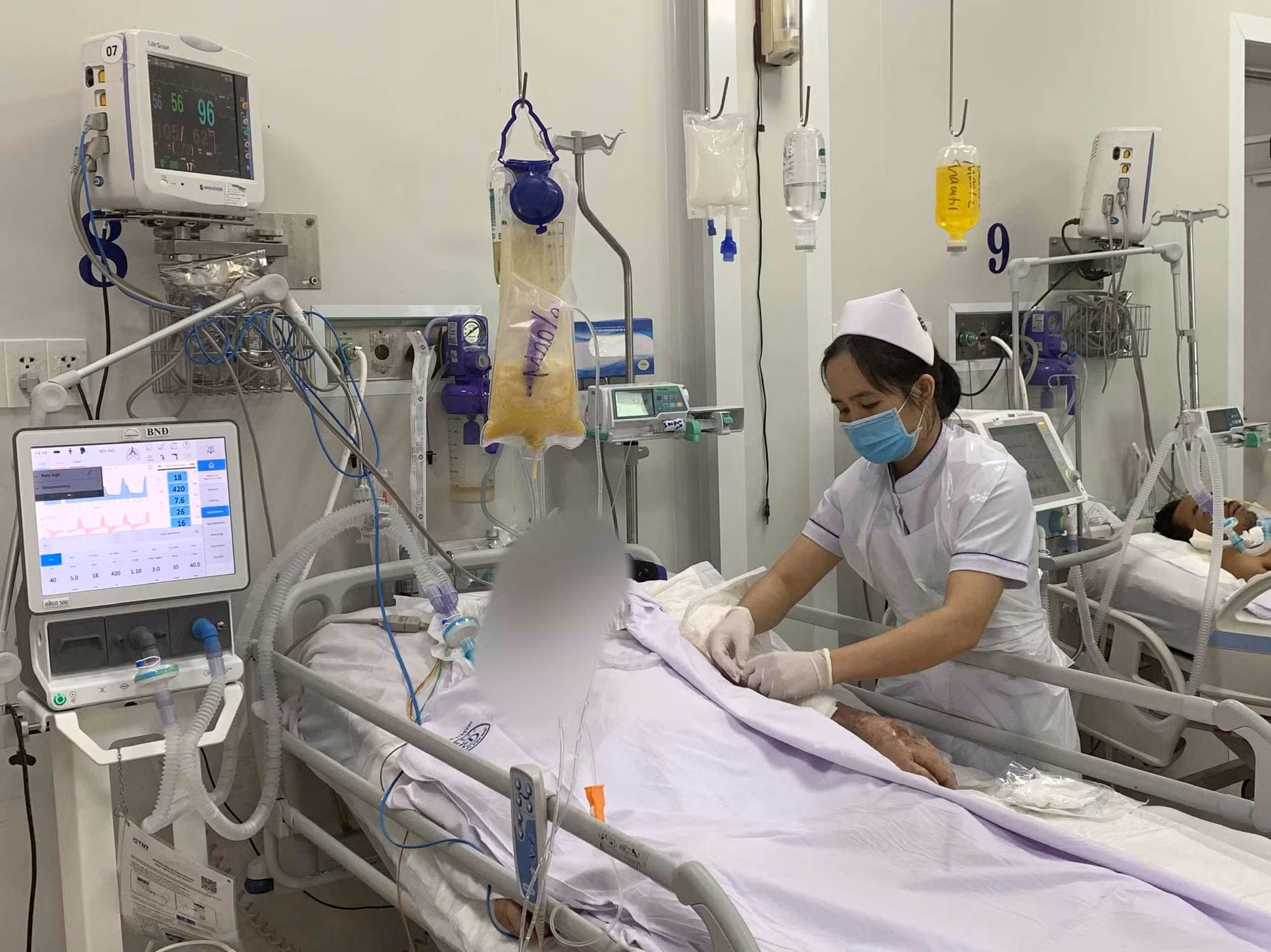 Người đàn ông ngộ độc thực phẩm tử vong do ăn bún mắm vợ nấu -0