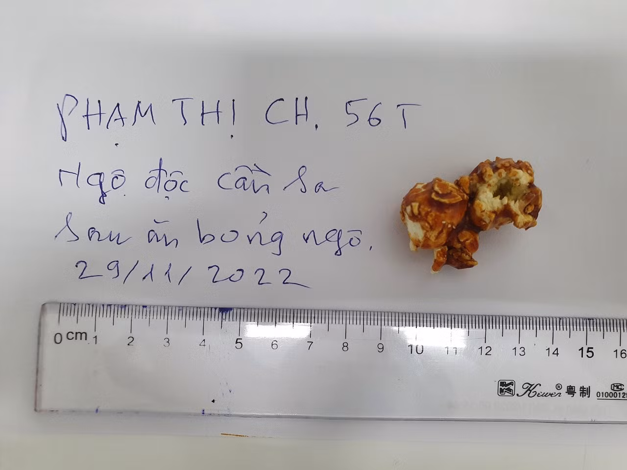 Ăn bỏng ngô tẩm cần sa, một phụ nữ phải nhập viện cấp cứu -0
