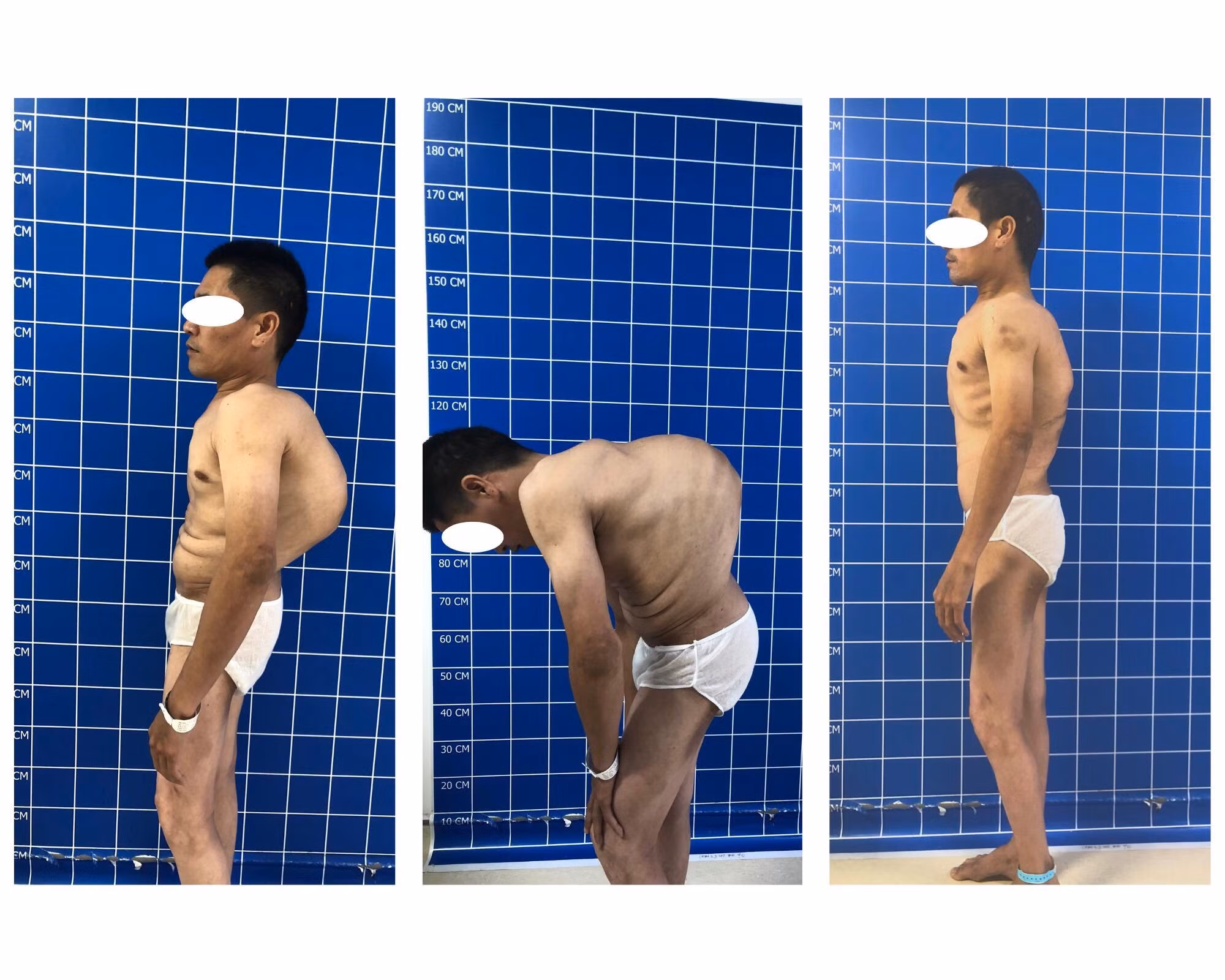 Tái sinh cho người đàn ông 40 tuổi bị 
