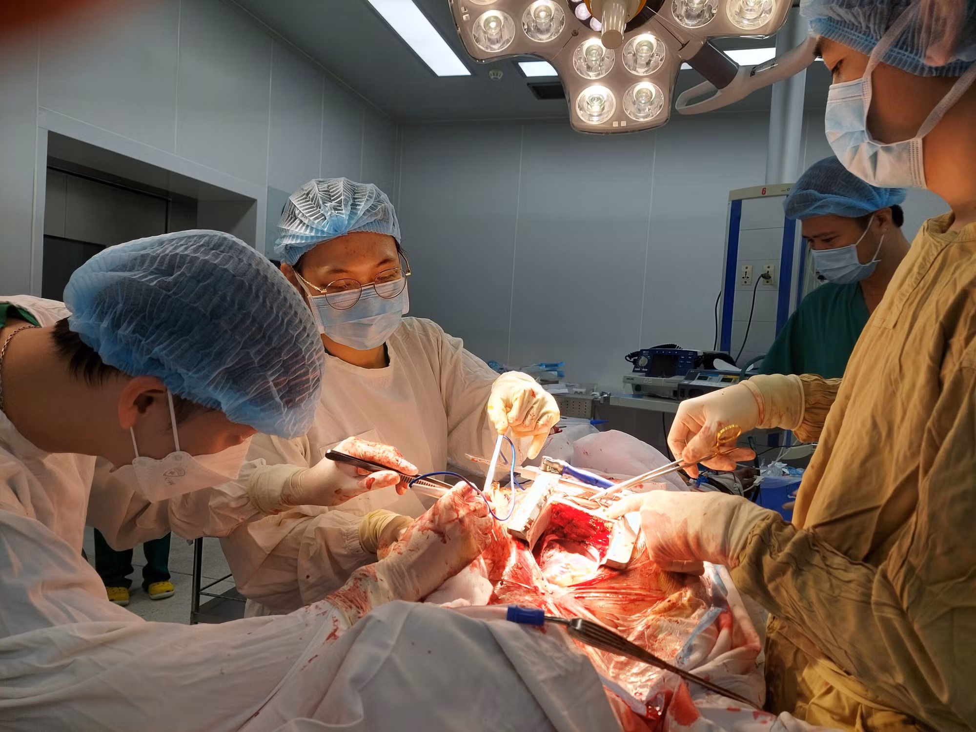 Cấp cứu tối khẩn, cứu sống bệnh nhân bị vết thương tim nguy hiểm -0