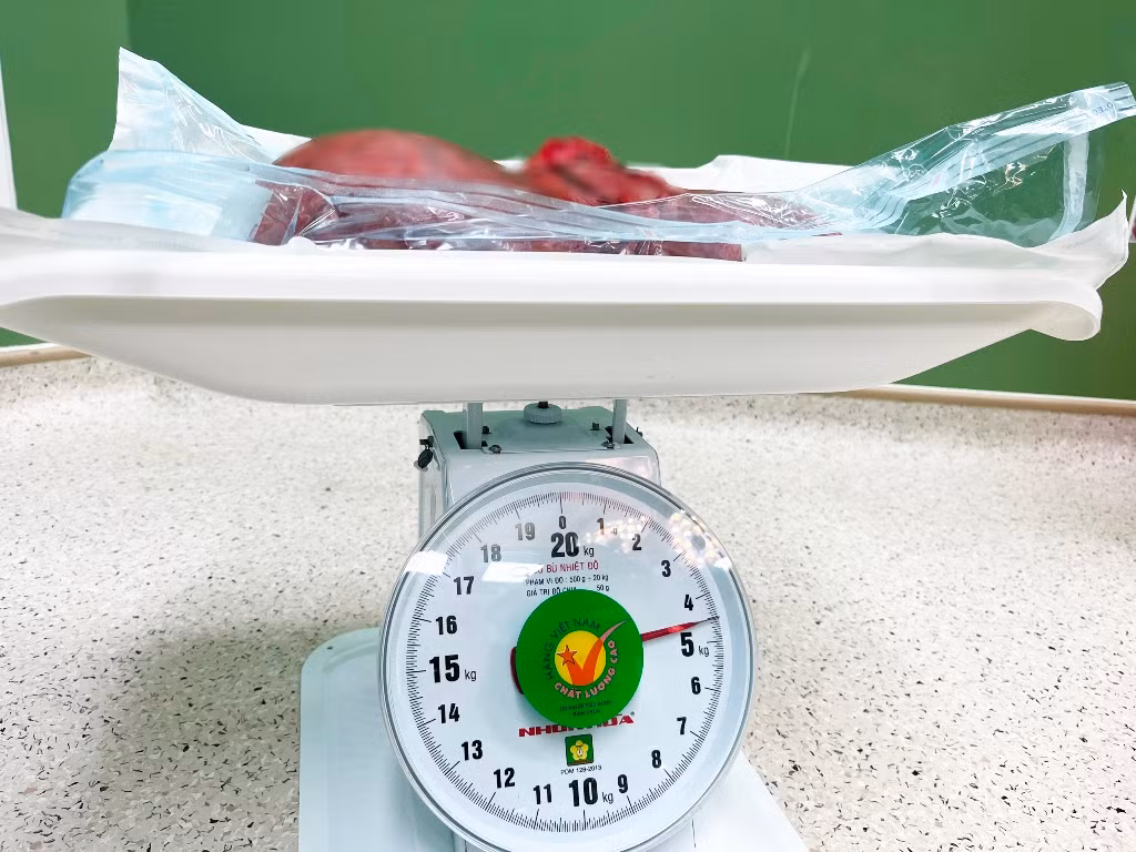 Đà Nẵng: Một phụ nữ “mang nặng” khối u xơ 4.5kg trong tử cung -2