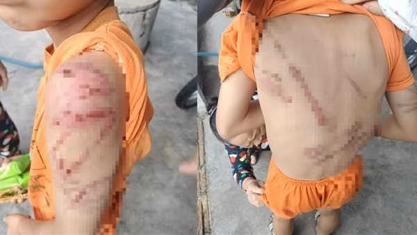 Điều tra vụ bé trai 10 tuổi bị bố bạo hành