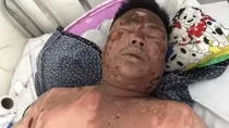 Hỏi tuổi bố bạn nhậu, bị hất cả nồi lẩu vào mặt