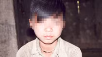 Những đứa trẻ bị "giời hành" ở Hà Giang