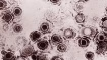 Virus biến đổi gene chống ung thư