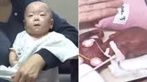 Bé trai sơ sinh nhỏ nhất thế giới