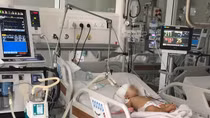 Khỉ nhà hàng xóm tấn công, 1 bé gái chấn thương nguy kịch 