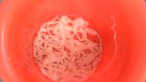 Hãi hùng sán xơ mít dài 9m trong bụng nam thanh niên