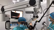 Lần đầu tiên ứng dụng điều trị ung thư vùng họng bằng dao Laser CO2