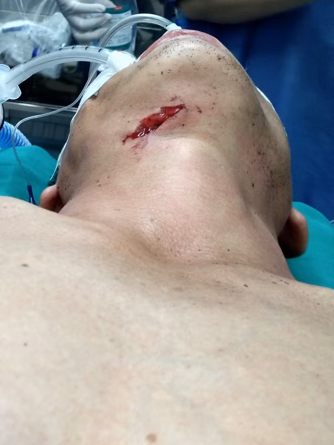 Bệnh nhân với vết thương ở cổ