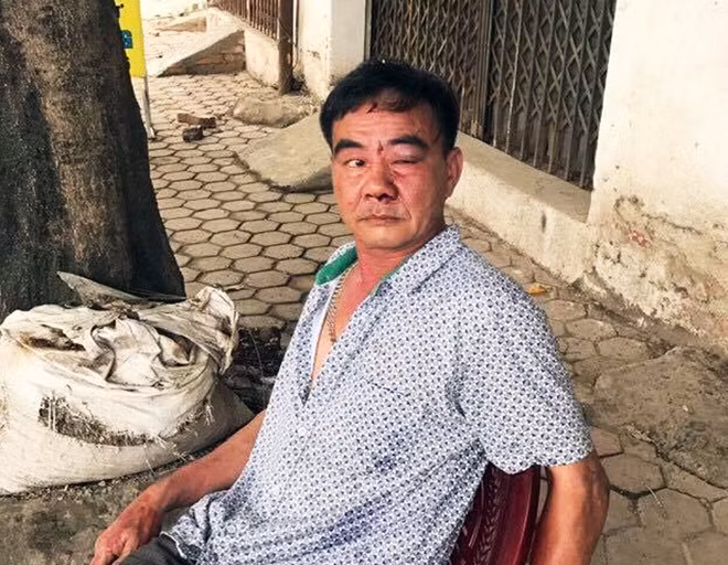 Ông Hoàng Văn Thảo sau khi bị hành hung.