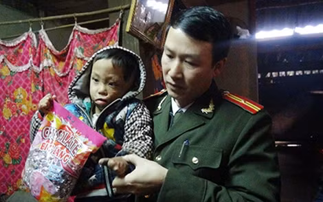Cháu Bàn Đức Anh bị bỏng nặng.