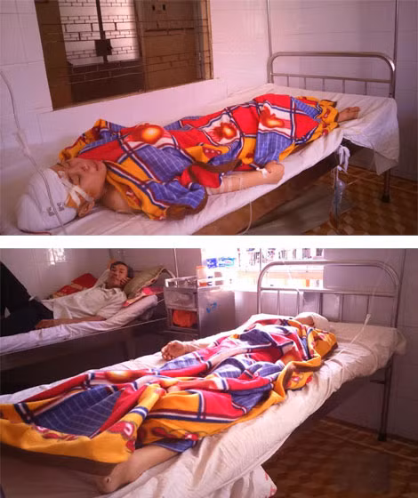 Mẹ con chị Hạnh đang được điều trị, cấp cứu tại Bệnh viện Đa khoa tỉnh Đắk Lắk.