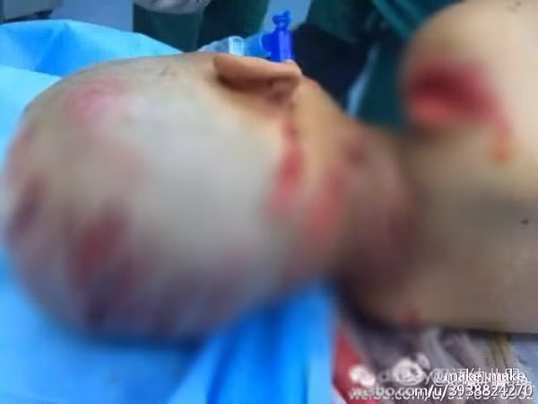 Hình ảnh của Lâm Lâm khi vừa được đưa vào viện. Ảnh: Weibo