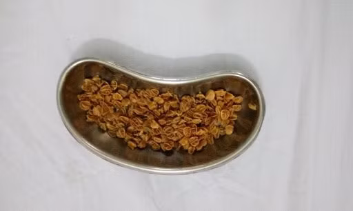 Trên 70g hạt sơ-ri, được các bác sỹ lấy ra từ hậu môn bệnh nhi P.