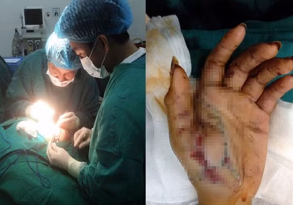 Hình ảnh bé trai 12 tuổi hỏng mắt, nát tay vì đốt pháo tại Nghệ An dịp Tết Nguyên đán 2016.