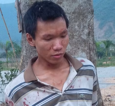 Nghịch tử Nguyễn Phước Linh lúc mới bị bắt. Nghịch tử Nguyễn Phước Linh lúc mới bị bắt.