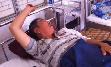 Vụ ném đá khiến ông Trương Triệu Lương bị vỡ nhãn cầu mắt trái. Vụ ném đá khiến ông Trương Triệu Lương bị vỡ nhãn cầu mắt trái.