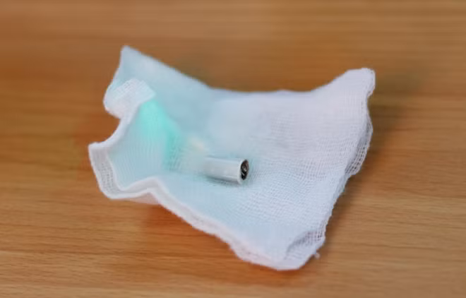 Lõi kèn được lấy ra khỏi đường thở của bé