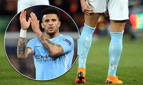 Kyle Walker ra sân với đôi tất rách.