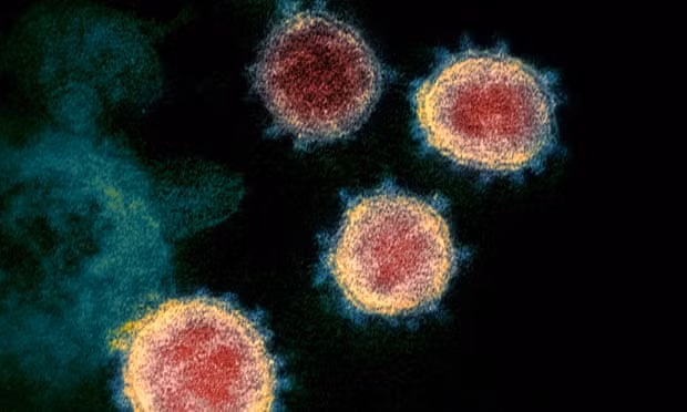 Hình ảnh của virus SARS-CoV-2 dưới kính hiển vi điện tử. Ảnh: AP