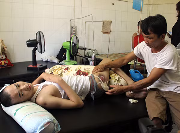 Ông Lê Văn Điều chăm sóc con trai tại Bệnh viện Trung ương Huế.
