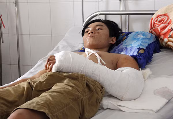 Anh Nhẫn đang điều trị tại Bệnh viện ĐKTW Cần Thơ.