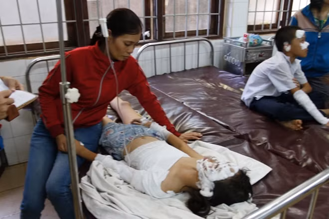 Một trong những học sinh bị bỏng được cấp cứu tại bệnh viện